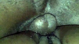 Chocolate Glazed Patient Receives Intense Doctor Treatment In Hospital