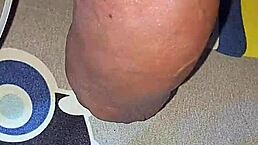 Gay man injects saline into cock