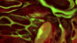 Otogibanashi No Onigokko Pianotaku Fansub Latino - Capitulo 1