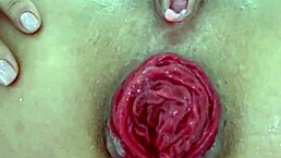Can You Handle This Juicy Prolapse Asshole Close Up?