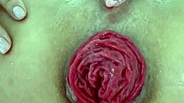 Can You Handle This Juicy Prolapse Asshole Close Up?