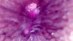 Prostitute Gets Anal Fucked with Open Ass!