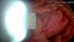 endoscope zooms on penis's super sensitive spots close-up